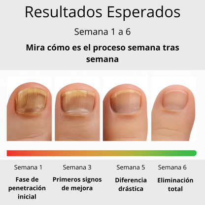 Parche Nocturno Antihongo Sellado™